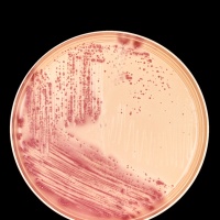 Agar Plate with E. coli bacteria